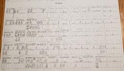 Thompson Township Cemetery Map - Section C, Lots 1-40 and Lots 71-78